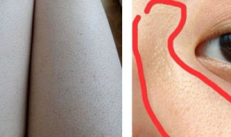 麻豆儿毛周角化修复霜,焕肤新选择，告别粗糙肌肤